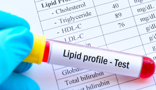 Lipid Profile Test