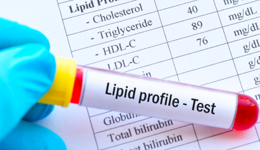 Lipid Test Package